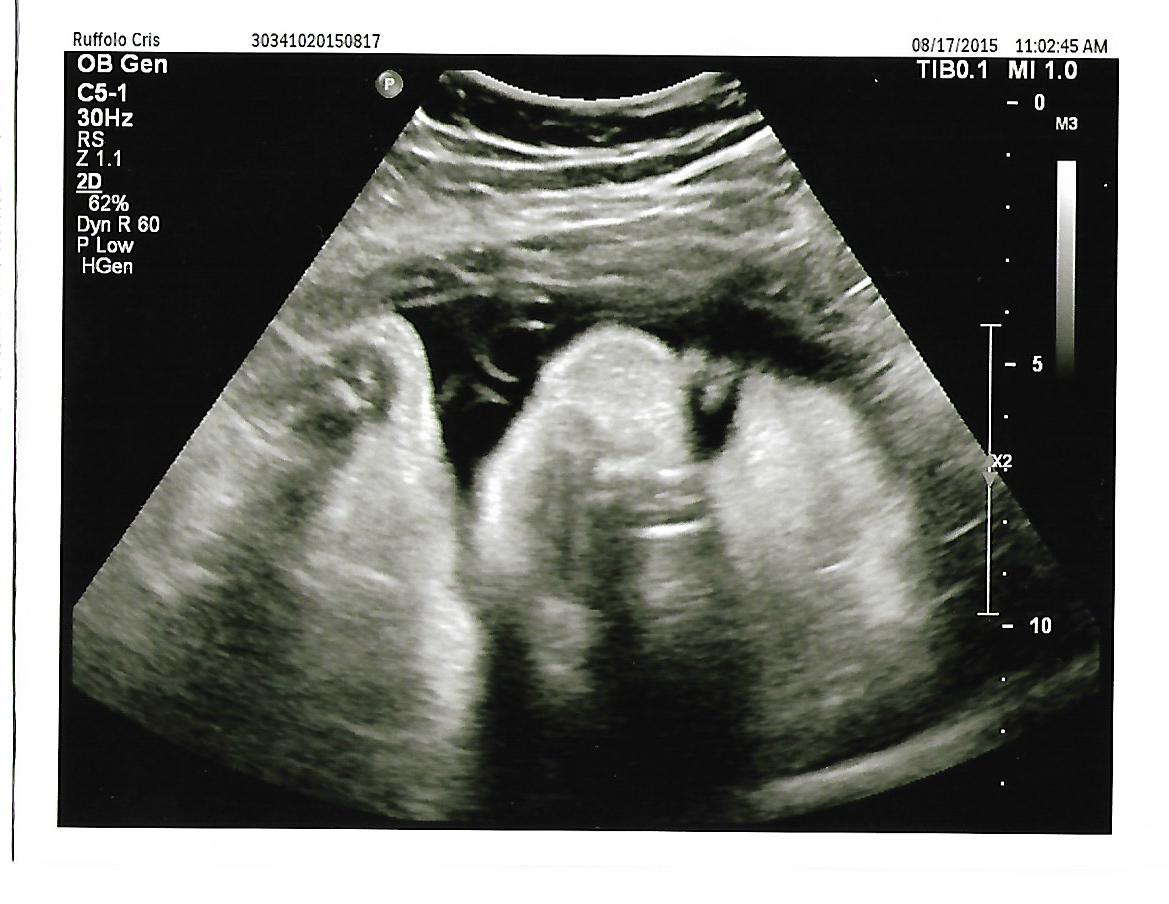 Pregnant with another chubby cheek - Jeff Jr 2 - readingruffolos